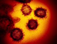 coronavirus