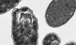 Infection Bacteria killing Drills Finally Get an Upgrade Breakthrough Study