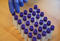 LabCorp first to get FDA green light for Covid 19 at home testing kit MedCity News