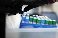 A medical researcher takes inventory at the Tulane National Primate Research Center in Covington, La., May 10.
PHOTO: KATHLEEN FLYNN/REUTERS
