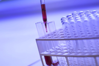 test tube